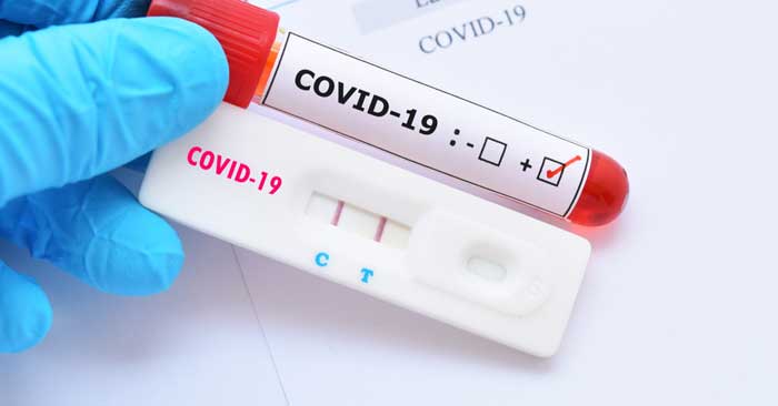 RN não registra óbitos e soma 84 novos casos de coronavírus nas últimas 24h; No total são 697 mortes e 19.290 infectados, de acordo com o Ministério da Saúde