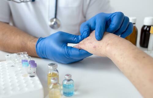 Ministério da Saúde amplia testagem de varíola dos macacos
