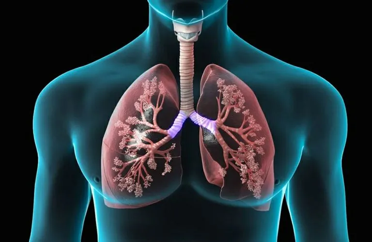 Síndromes respiratórias graves apresentam tendência de alta no RN
